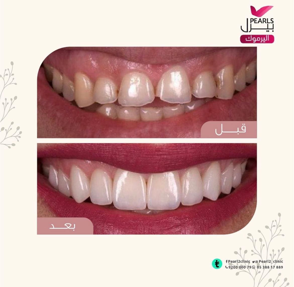 Description of image